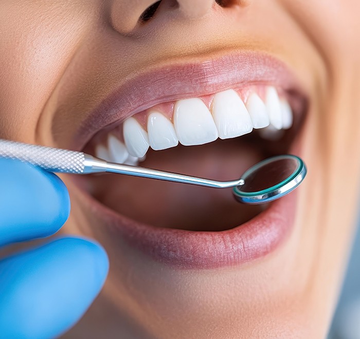 Restore your beautiful smile with cosmetic dental bonding